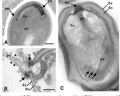  Mikrosporidien!  Parasiten mit winzigen Sporen – Meister der Manipulation und Überlebenskunst?