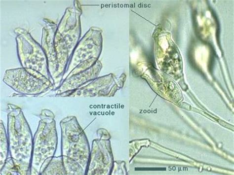 Opercularia!  Ein Einzeller mit einem Geheimnisvollen Operculum für eine effiziente Fortbewegung und Nahrungsaufnahme