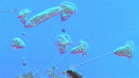  Vorticella! Ein winziger Wirbelwind der Unterwasserwelt